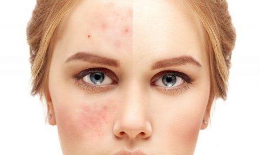 Restoring your skin when you work in Customer Service