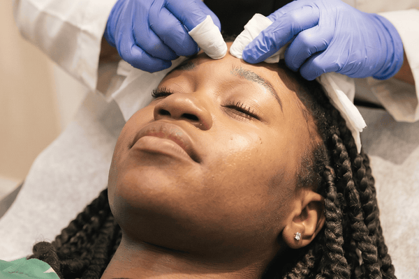 Professional skin assessment at the Perfec-Tone studio for cystic acne