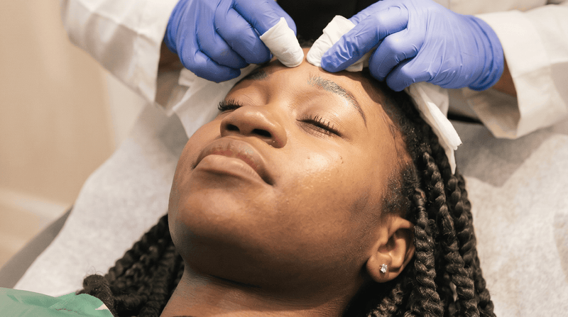 Professional skin assessment at the Perfec-Tone studio for cystic acne
