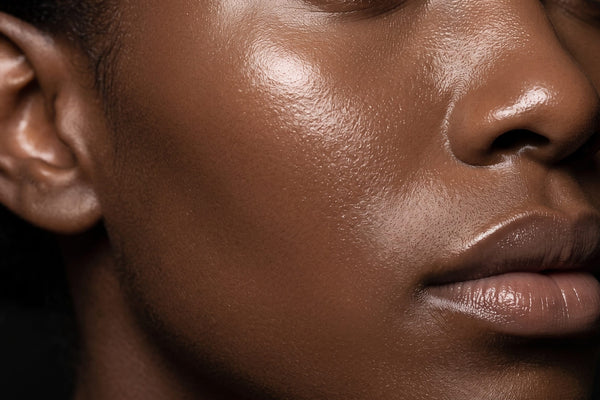 Close-up of clear cheek skin after treating breakouts