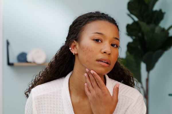 Woman examining dark spots on her skin in a bathroom mirror before starting a dark spot corrector