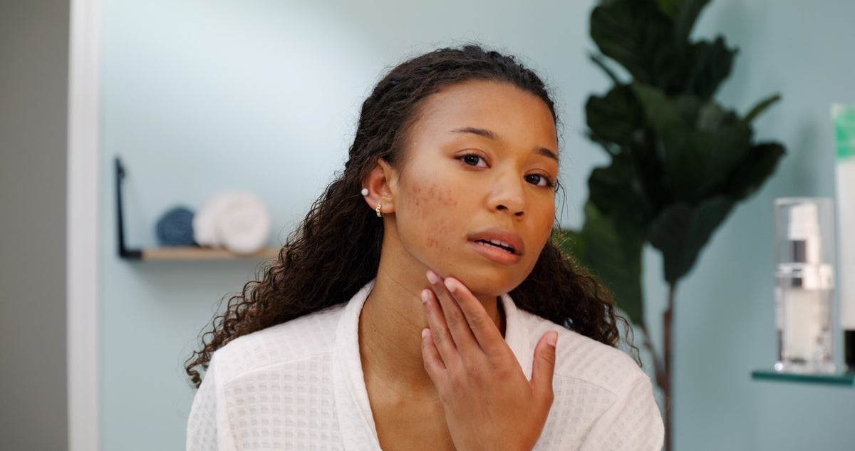 Dark Spot Corrector: What Actually Works, and How Fast