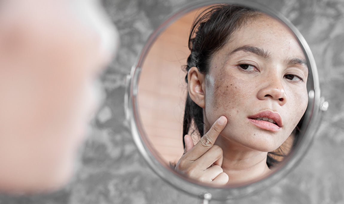 Distinguishing Characteristics of Normal and Malignant Moles