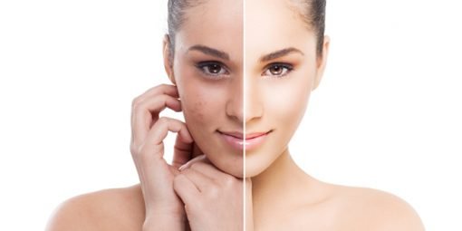 Why Bleaching With Chemical Lighteners Can Be Dangerous