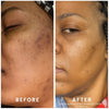 Perfec-Tone Clinical Strength Resurfacing Crème 30ml and 50ml