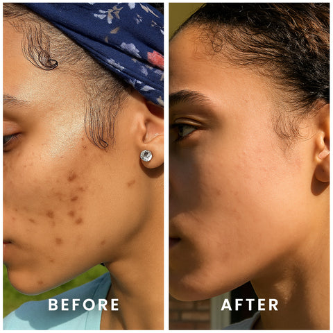 Clarifying Gel