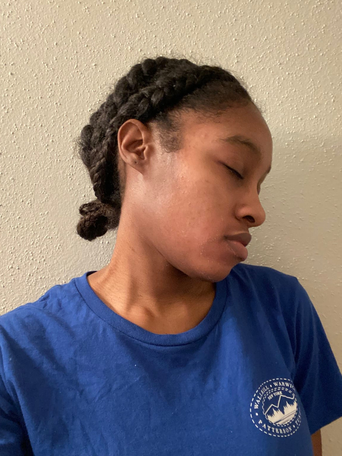 Eryqa’s right-side profile in a blue shirt with clearer-looking skin, in a customer-provided photo.