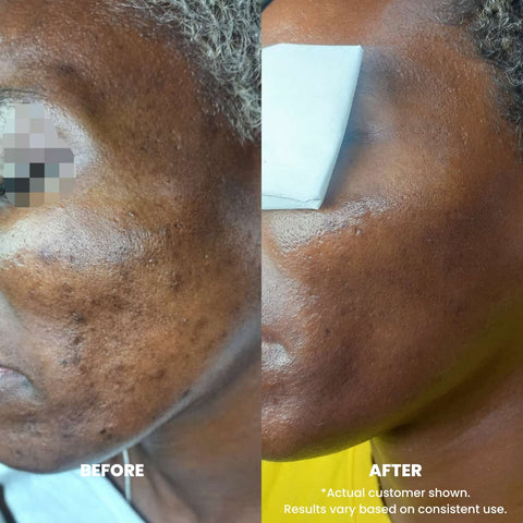 Perfec-Tone Clinical Strength Resurfacing Crème 30ml and 50ml