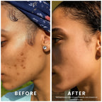 Perfec-Tone Products Clarifying Gel