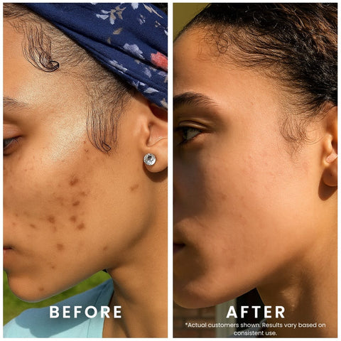 Perfec-Tone Products Clarifying Gel