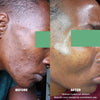 Perfec-Tone Products Resurfacing Crème